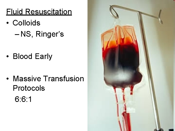 Fluid Resuscitation • Colloids – NS, Ringer’s • Blood Early • Massive Transfusion Protocols