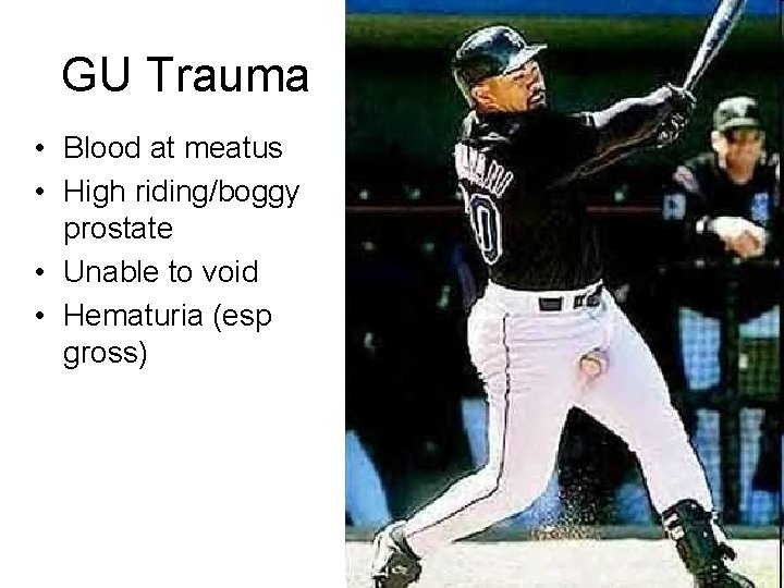 GU Trauma • Blood at meatus • High riding/boggy prostate • Unable to void