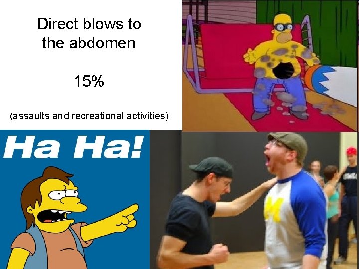 Direct blows to the abdomen 15% (assaults and recreational activities) 