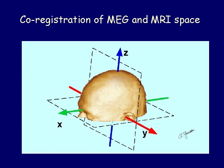 Co-registration of MEG and MRI space 