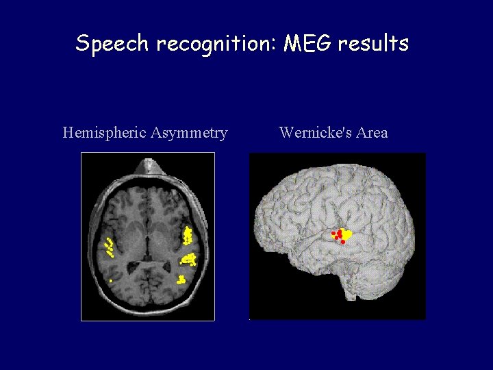 Speech recognition: MEG results Hemispheric Asymmetry Wernicke's Area 