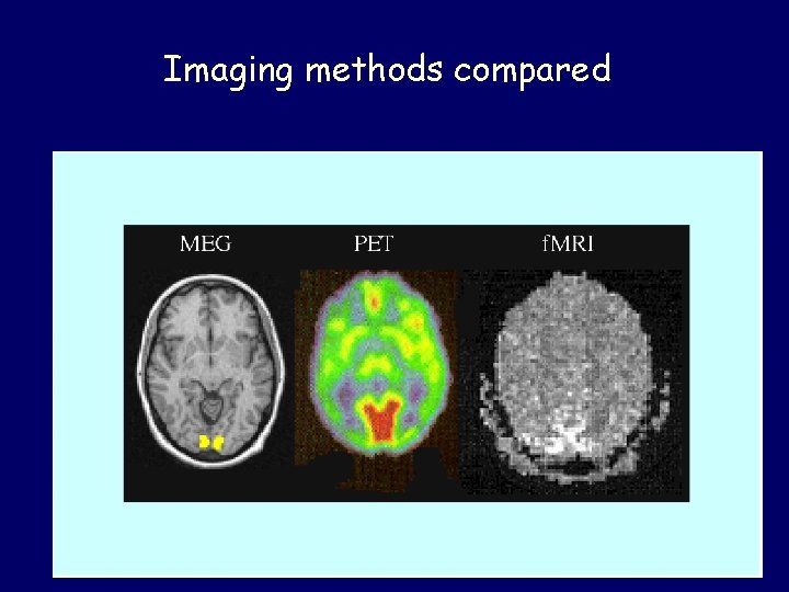 Imaging methods compared 