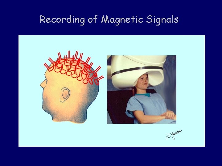 Recording of Magnetic Signals 