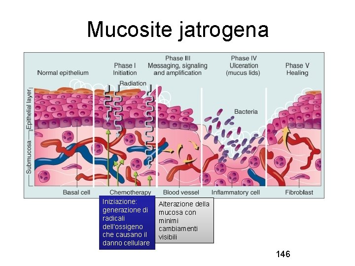 Mucosite jatrogena Iniziazione: generazione di radicali dell’ossigeno che causano il danno cellulare Alterazione della