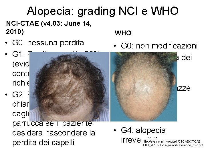 Alopecia: grading NCI e WHO NCI-CTAE (v 4. 03: June 14, 2010) WHO •
