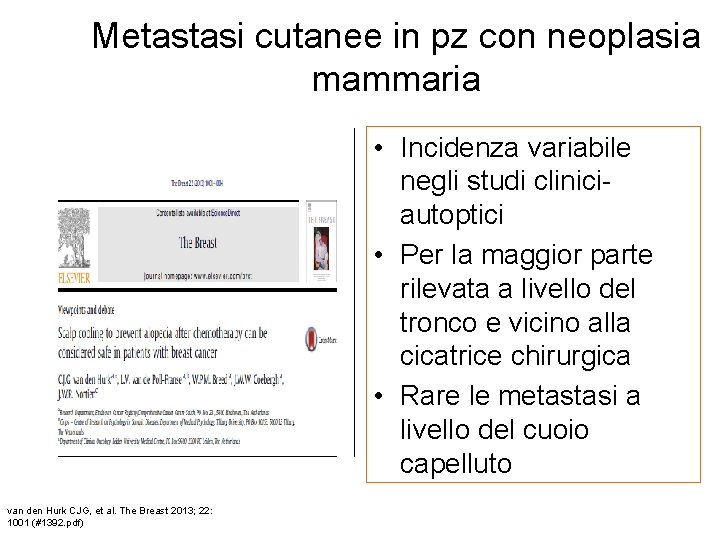 Metastasi cutanee in pz con neoplasia mammaria • Incidenza variabile negli studi cliniciautoptici •