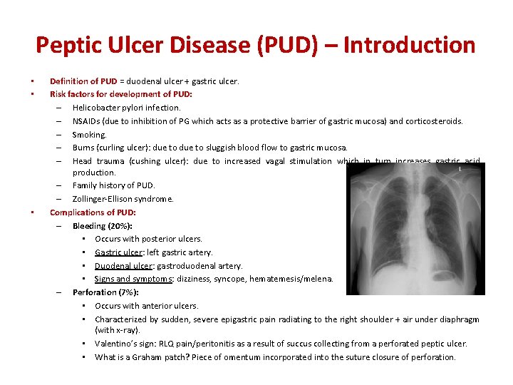 Peptic Ulcer Disease (PUD) – Introduction • • • Definition of PUD = duodenal