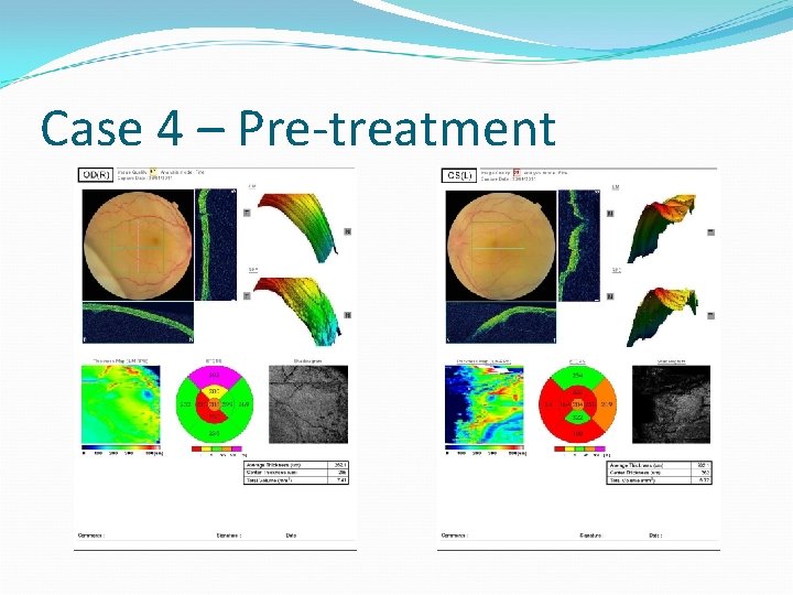 Case 4 – Pre-treatment 