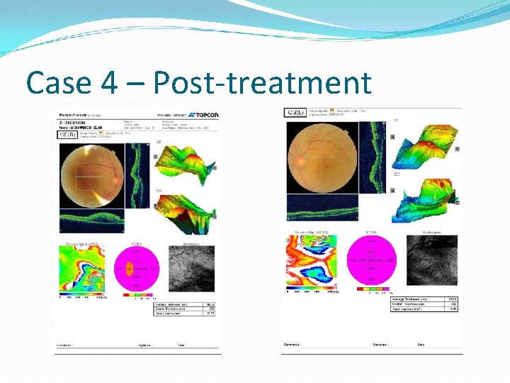 Case 4 – Post-treatment 