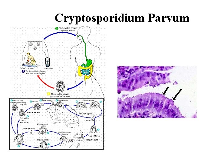 Cryptosporidium Parvum 