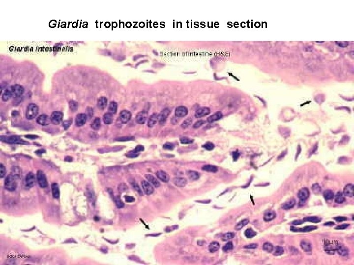 Giardia trophozoites in tissue section 