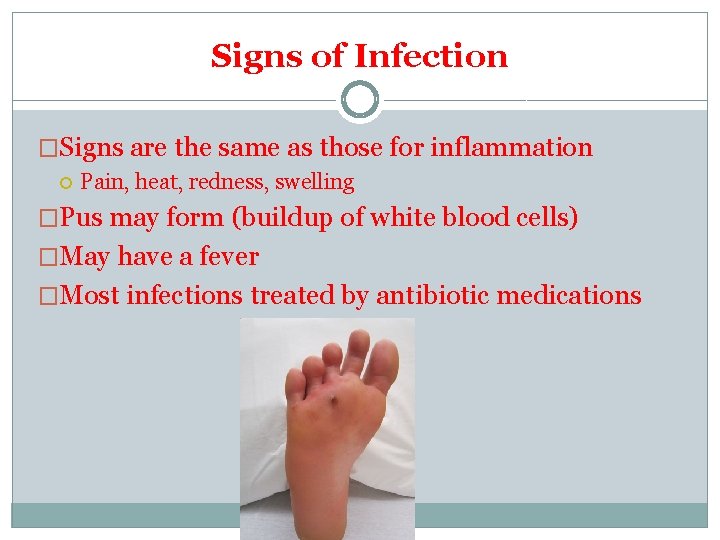 Signs of Infection �Signs are the same as those for inflammation Pain, heat, redness,