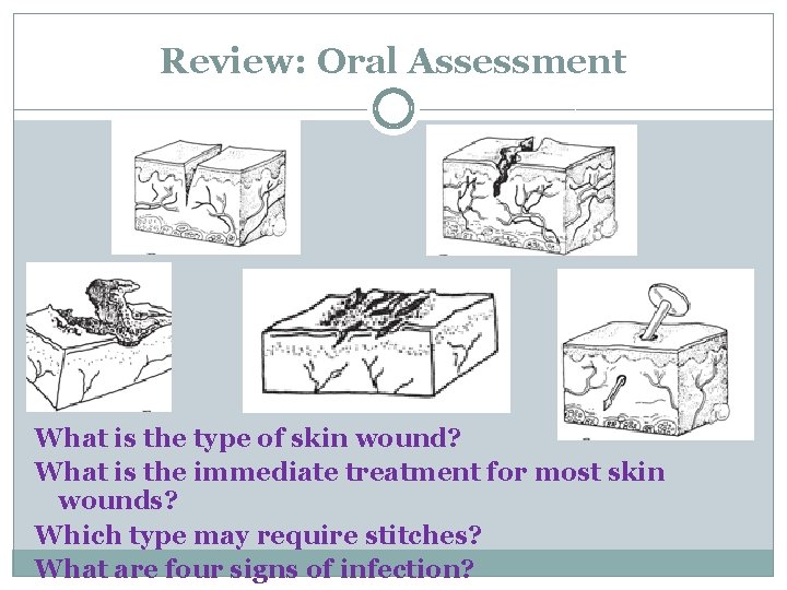 Review: Oral Assessment What is the type of skin wound? What is the immediate