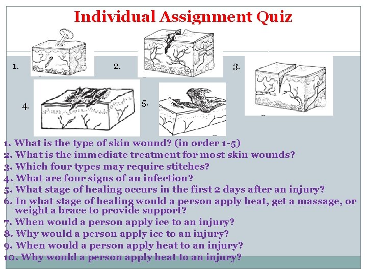 Individual Assignment Quiz 1. 2. 4. 3. 5. . is the type of skin
