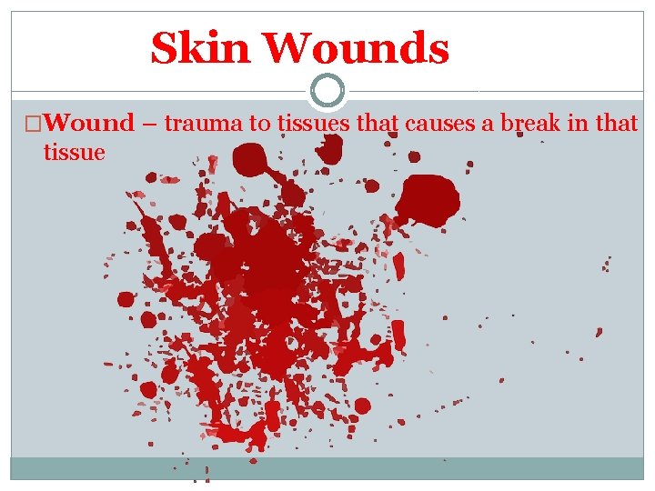 Skin Wounds �Wound – trauma to tissues that causes a break in that tissue
