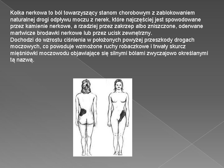 Kolka nerkowa to ból towarzyszący stanom chorobowym z zablokowaniem naturalnej drogi odpływu moczu z