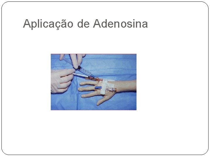 Aplicação de Adenosina 