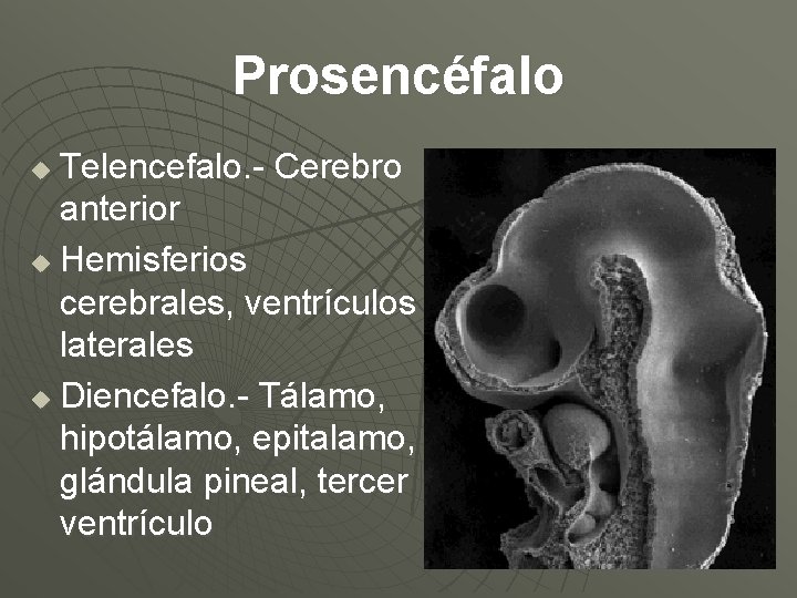 Prosencéfalo Telencefalo. - Cerebro anterior u Hemisferios cerebrales, ventrículos laterales u Diencefalo. - Tálamo,