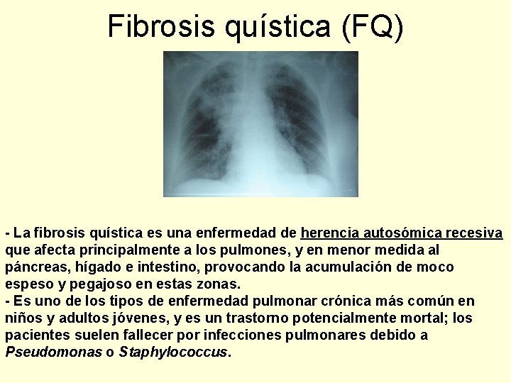 Fibrosis quística (FQ) - La fibrosis quística es una enfermedad de herencia autosómica recesiva