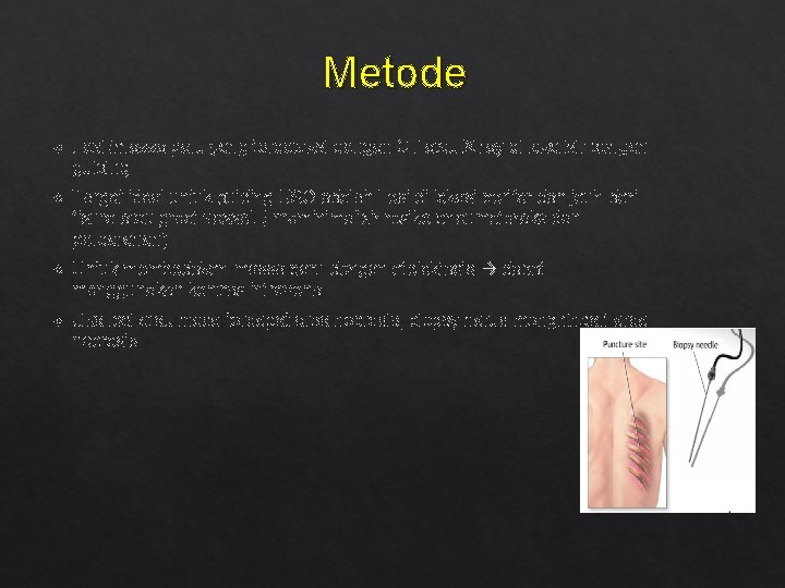 Metode Lesi /massa paru yang terdeteksi dengan CT atau X ray di lokalisir dengan