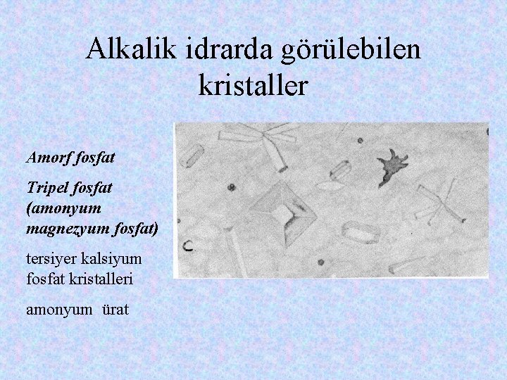 Alkalik idrarda görülebilen kristaller Amorf fosfat Tripel fosfat (amonyum magnezyum fosfat) tersiyer kalsiyum fosfat