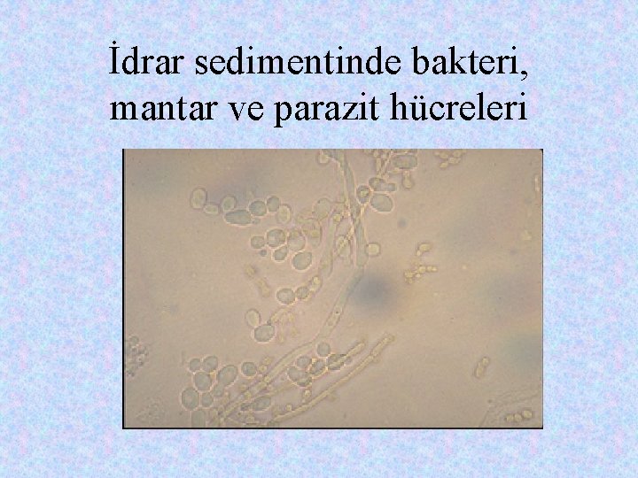 İdrar sedimentinde bakteri, mantar ve parazit hücreleri 