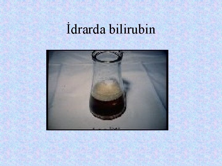 İdrarda bilirubin 