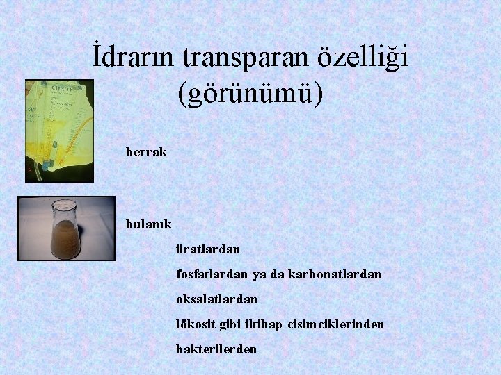 İdrarın transparan özelliği (görünümü) berrak bulanık üratlardan fosfatlardan ya da karbonatlardan oksalatlardan lökosit gibi