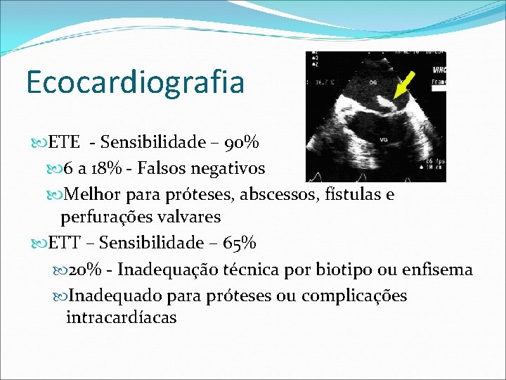 Ecocardiografia ETE - Sensibilidade – 90% 6 a 18% - Falsos negativos Melhor para