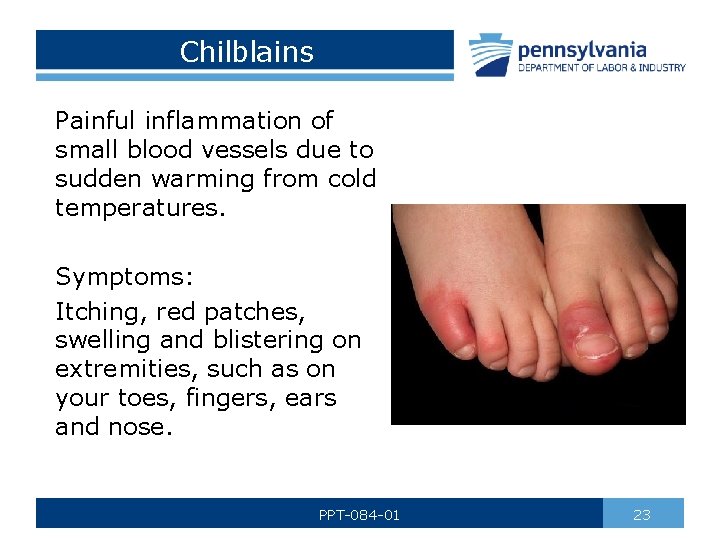 Chilblains Painful inflammation of small blood vessels due to sudden warming from cold temperatures.