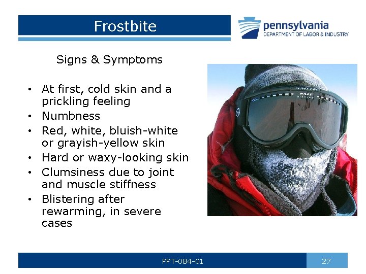 Frostbite Signs & Symptoms • At first, cold skin and a prickling feeling •