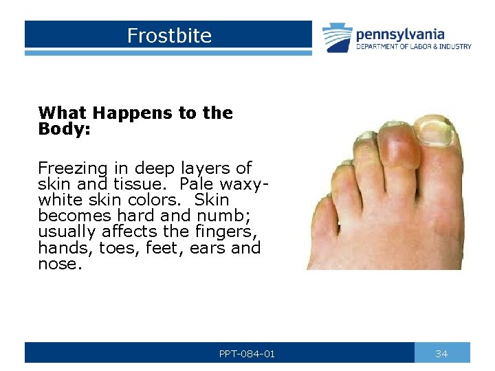 Frostbite What Happens to the Body: Freezing in deep layers of skin and tissue.