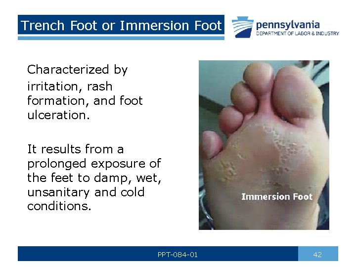 Trench Foot or Immersion Foot Characterized by irritation, rash formation, and foot ulceration. It