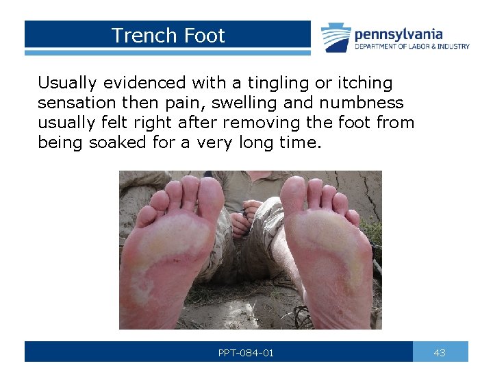 Trench Foot Usually evidenced with a tingling or itching sensation then pain, swelling and