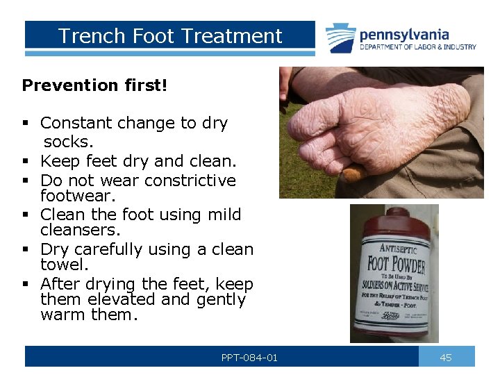 Trench Foot Treatment Prevention first! § Constant change to dry socks. § Keep feet