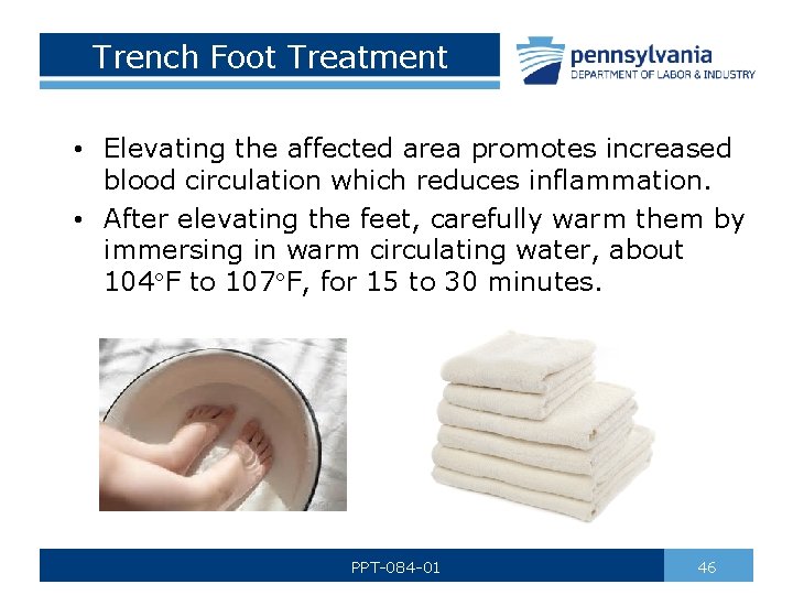 Trench Foot Treatment • Elevating the affected area promotes increased blood circulation which reduces