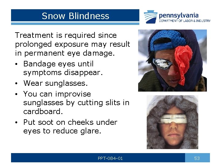 Snow Blindness Treatment is required since prolonged exposure may result in permanent eye damage.