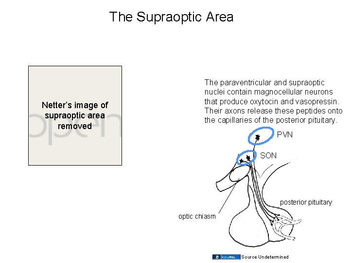 The Supraoptic Area Netter’s image of supraoptic area removed The paraventricular and supraoptic nuclei