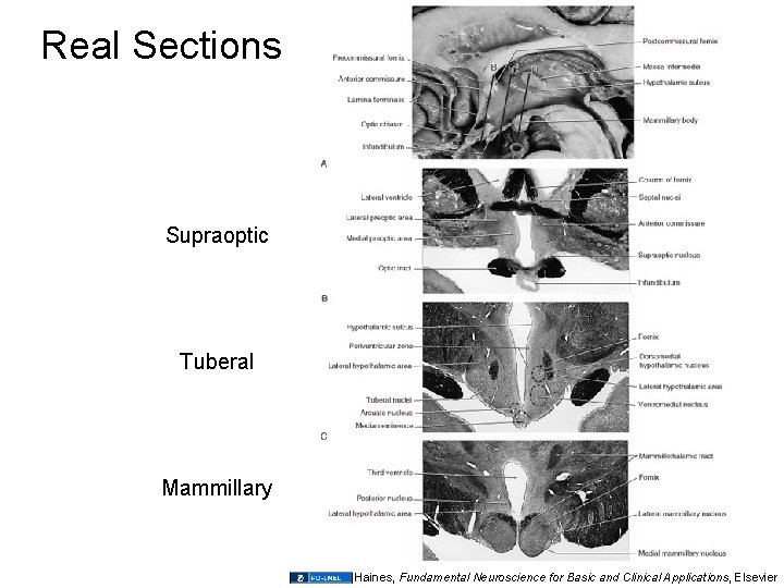 Real Sections Supraoptic Tuberal Mammillary Haines, Fundamental Neuroscience for Basic and Clinical Applications, Elsevier