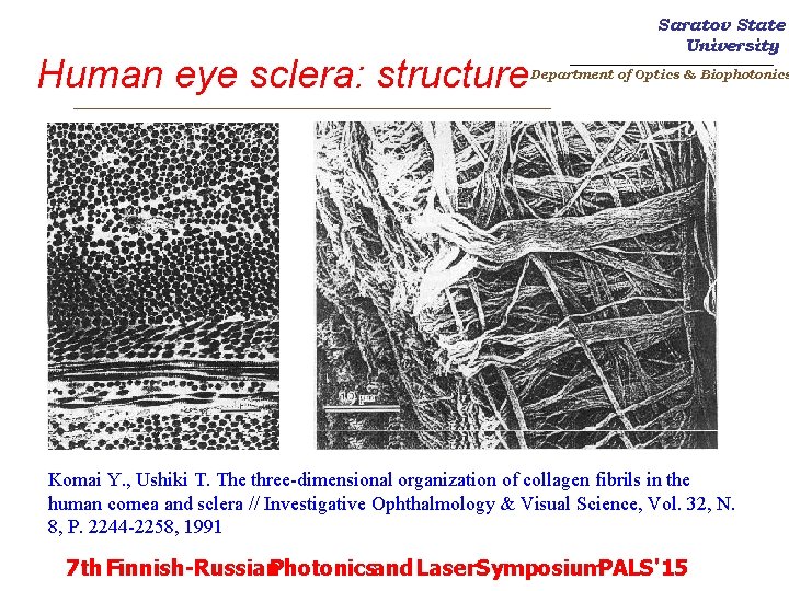 Human eye sclera: structure _________________________ Saratov State University _______________________ Department of Optics & Biophotonics