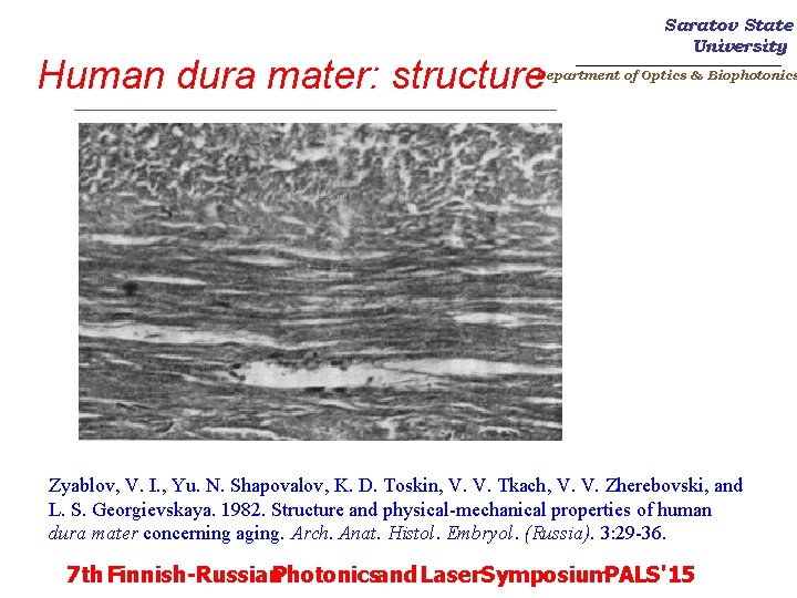 Human dura mater: structure _________________________ Saratov State University _______________________ Department of Optics & Biophotonics