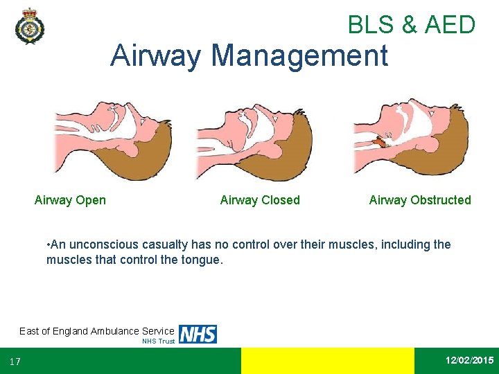 BLS & AED Airway Management Airway Open Airway Closed Airway Obstructed • An unconscious