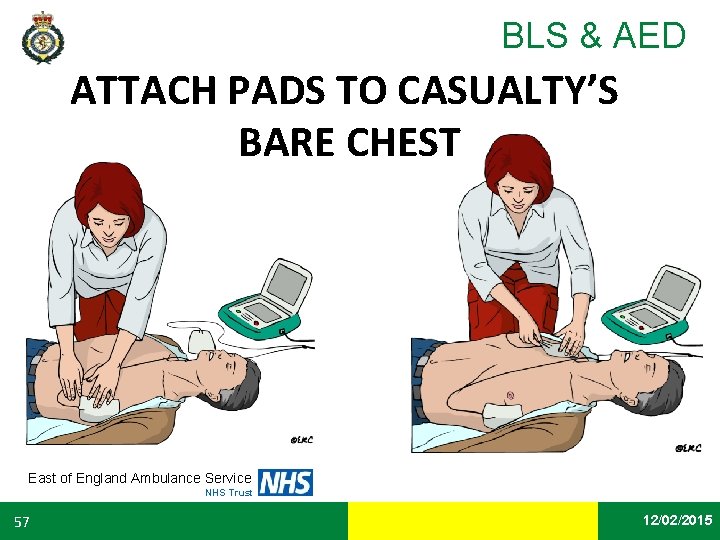 BLS & AED ATTACH PADS TO CASUALTY’S BARE CHEST East of England Ambulance Service