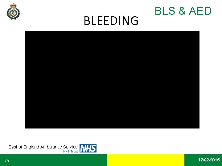 BLEEDING BLS & AED East of England Ambulance Service NHS Trust 75 Date 12/02/2015