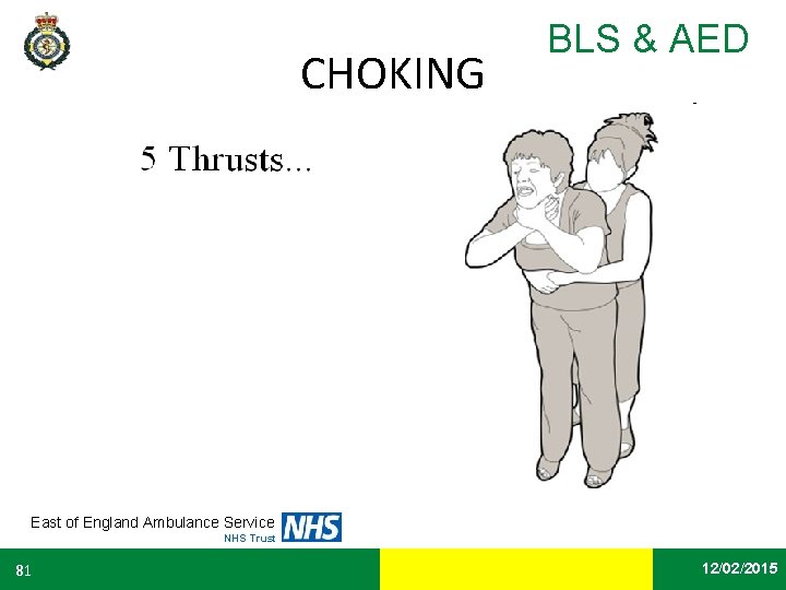 CHOKING BLS & AED East of England Ambulance Service NHS Trust 81 Date 12/02/2015