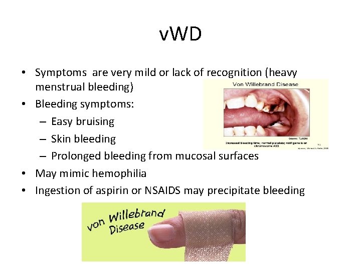 v. WD • Symptoms are very mild or lack of recognition (heavy menstrual bleeding)