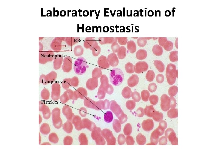 Laboratory Evaluation of Hemostasis 