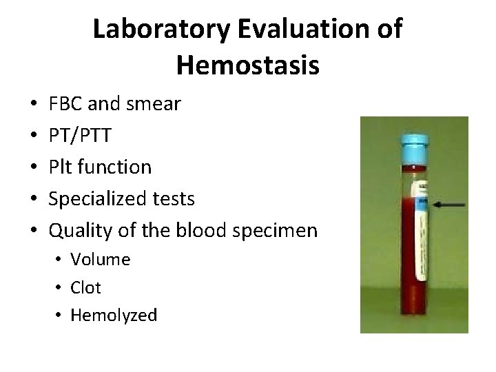 Laboratory Evaluation of Hemostasis • • • FBC and smear PT/PTT Plt function Specialized