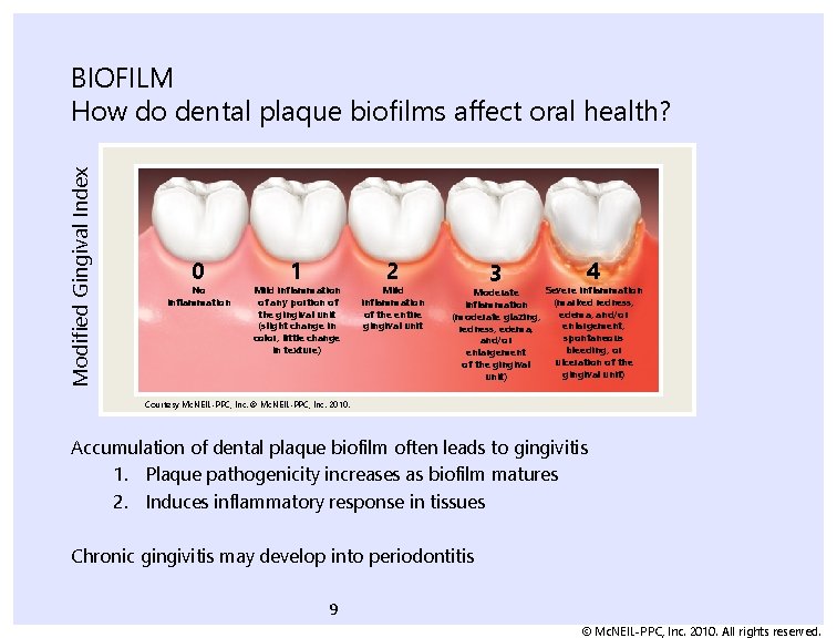 Modified Gingival Index BIOFILM How do dental plaque biofilms affect oral health? 0 No