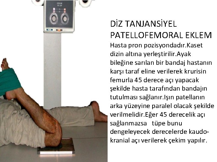 DİZ TANJANSİYEL PATELLOFEMORAL EKLEM Hasta pron pozisyondadır. Kaset dizin altına yerleştirilir. Ayak bileğine sarılan